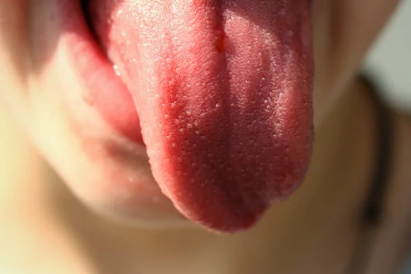 tongue-822441_1920-1200x800