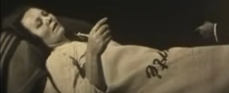 PersonWithSleepySicknessIn1925