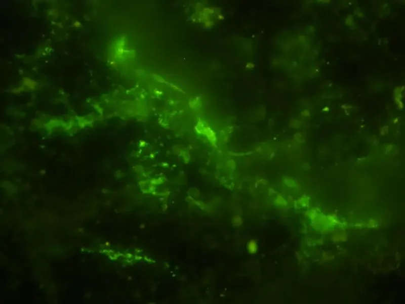 ancient-microbial-cells-stained-green-l