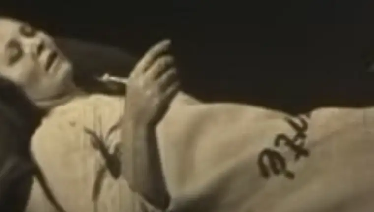PersonWithSleepySicknessIn1925
