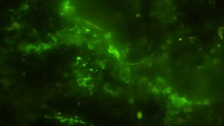 ancient-microbial-cells-stained-green-l