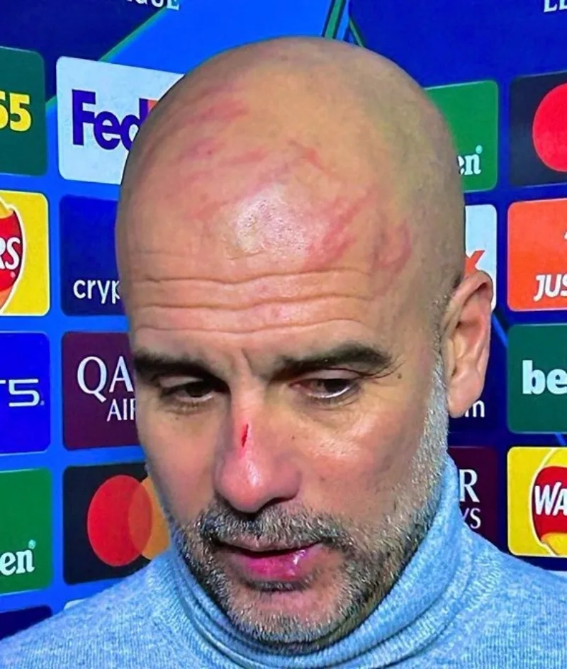 guardiola