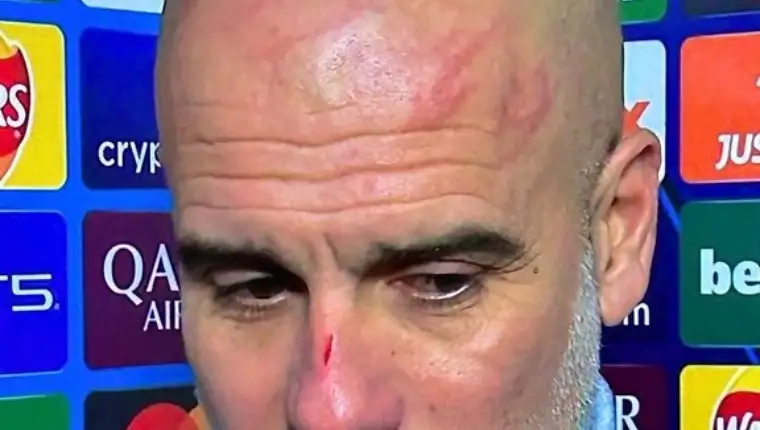 guardiola