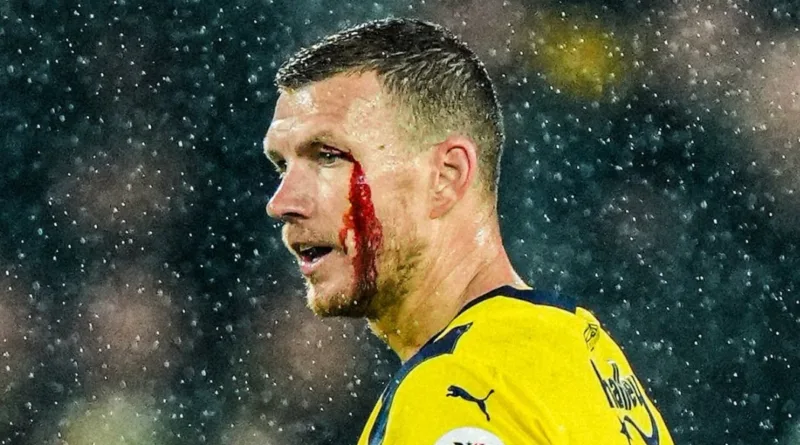 dzeko