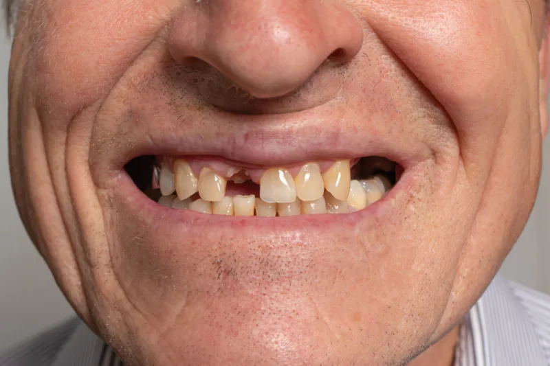 The toothless smile of an old European man on a gray background.