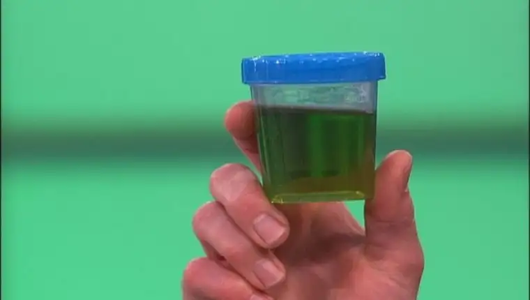 zelena mokraća