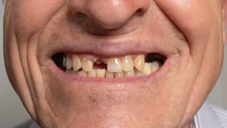 The toothless smile of an old European man on a gray background.