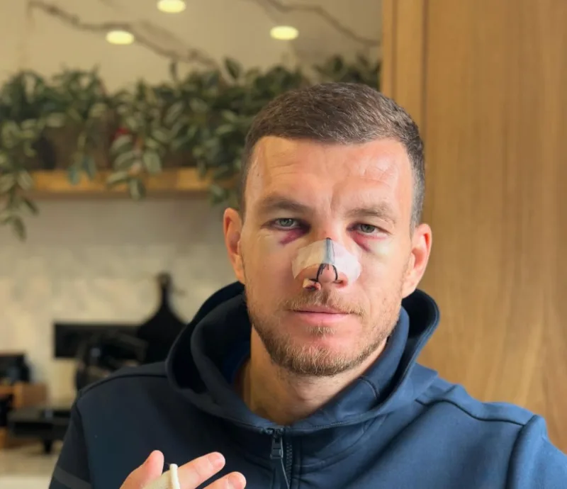 dzeko 1