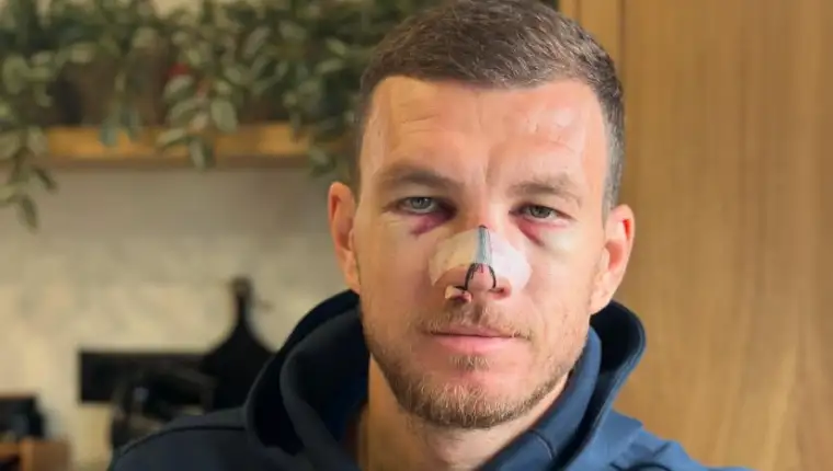 dzeko 1