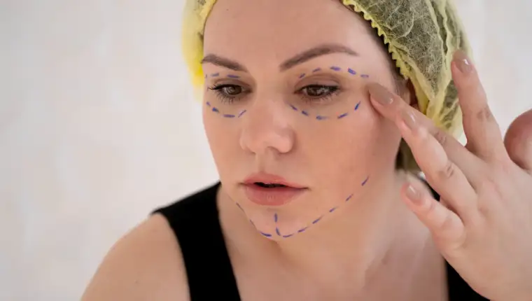 Facelifting