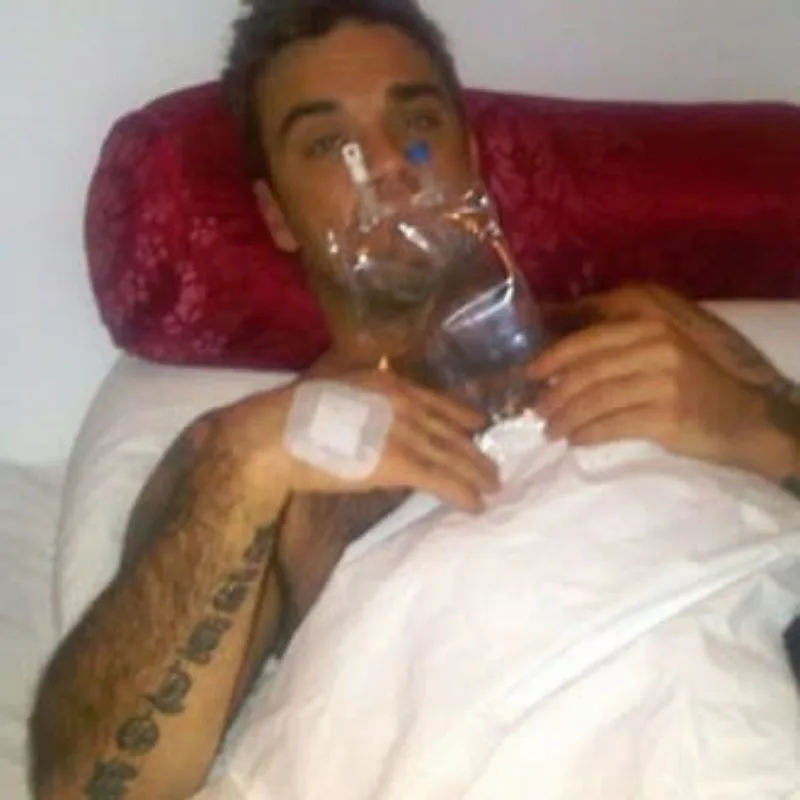 robbie williams skorbut bolest