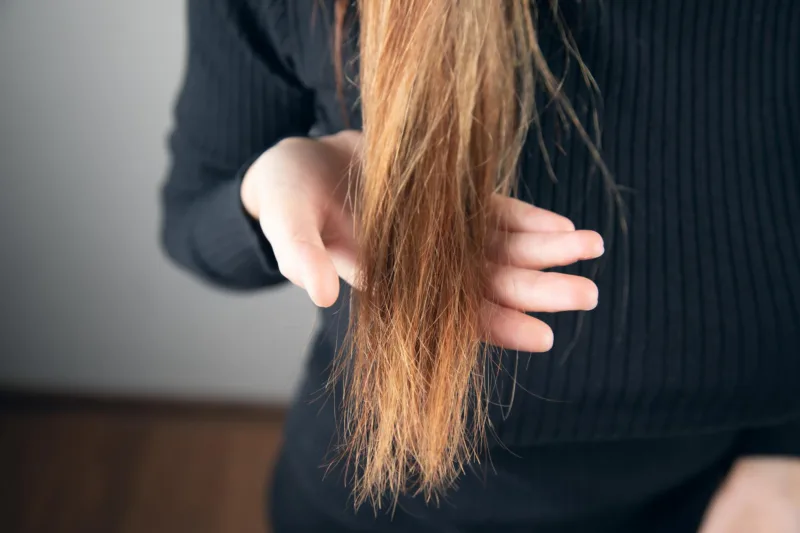 lomljiva kosa manjak željeza freepik