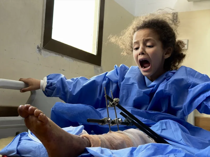 AA-20250527-38095544-38095541-PALESTINSKOJ_OSMOGODISNJAKINJI_AMPUTIRANA_NOGA_NAKON_IZRAELSKOG_NAPADA_NA_SATOR_U_GAZI