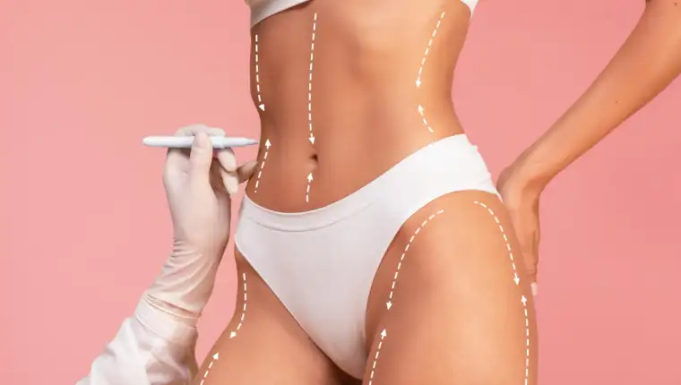 liposukcija