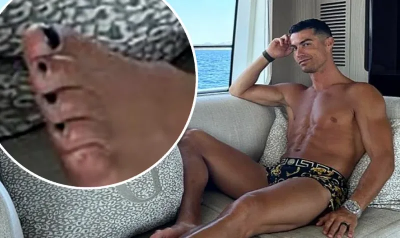 cristiano ronaldo nokti1