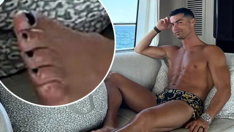 cristiano ronaldo nokti1
