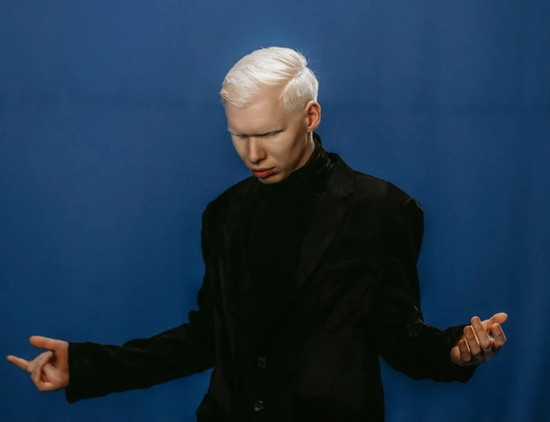 Albino image_3