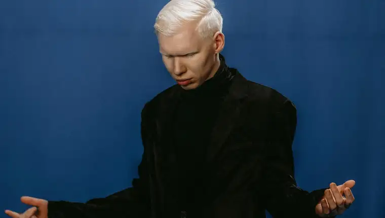 Albino image_3
