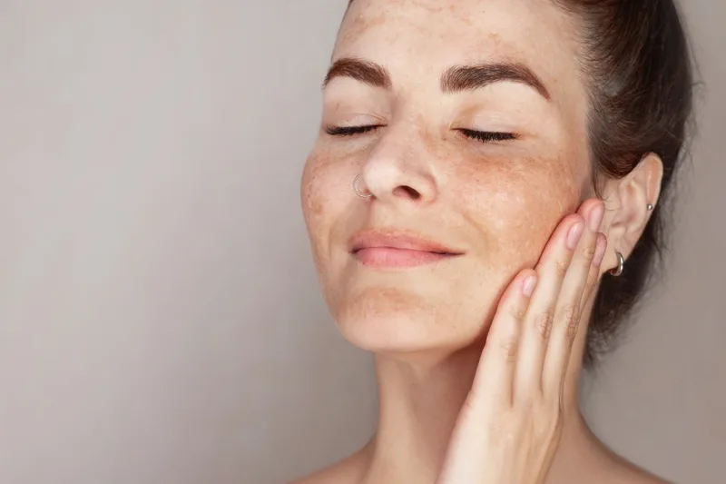 Caucasian woman's face with freckles or age spots, she loves her skin