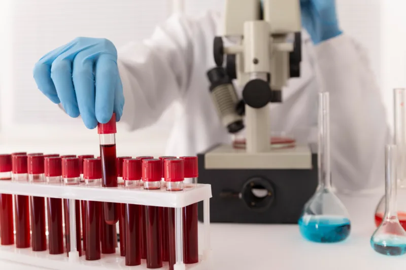 laboratorija krv freepik