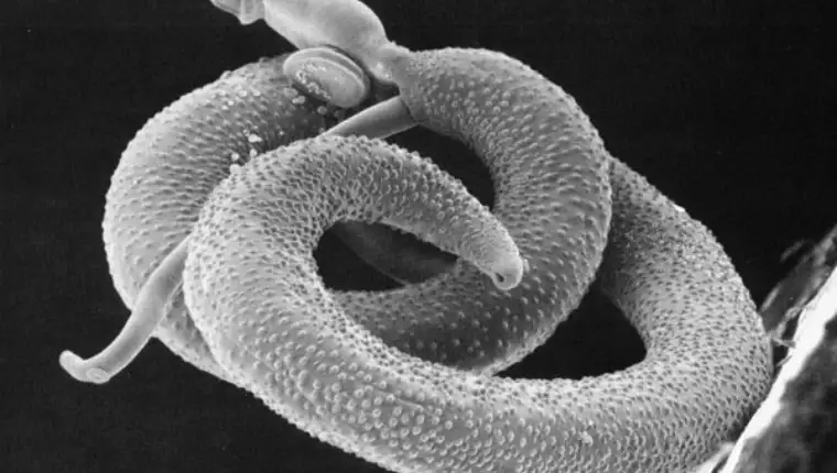 Schistosoma mansoni