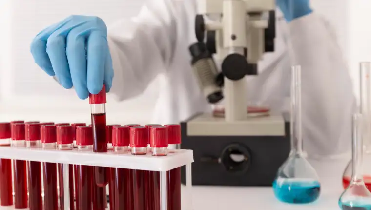laboratorija krv freepik