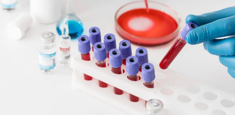 krv freepik