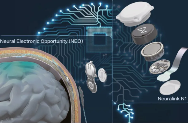 Neural Electronic Opportunity