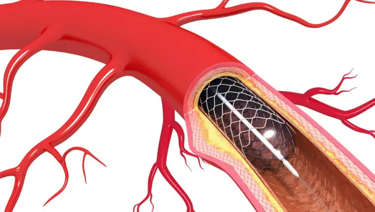 arterija freepik