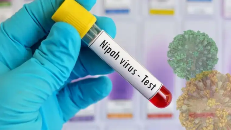 Nipah123