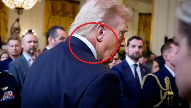 Trump osip x
