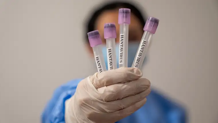 Hantavirus 1