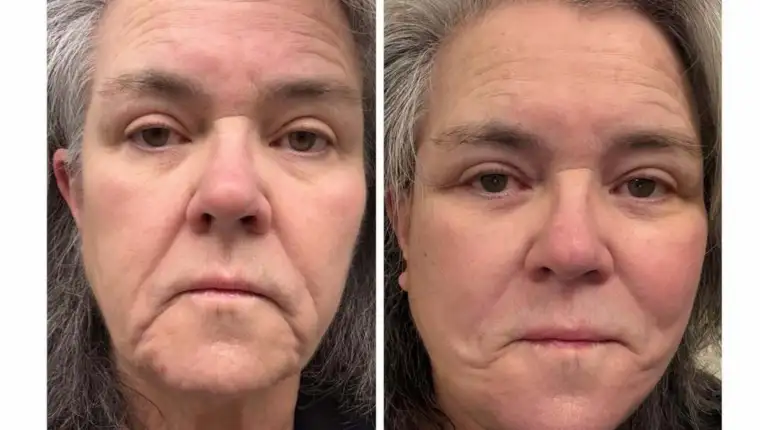 THE B4 AFTER story on substack rosieodonnell