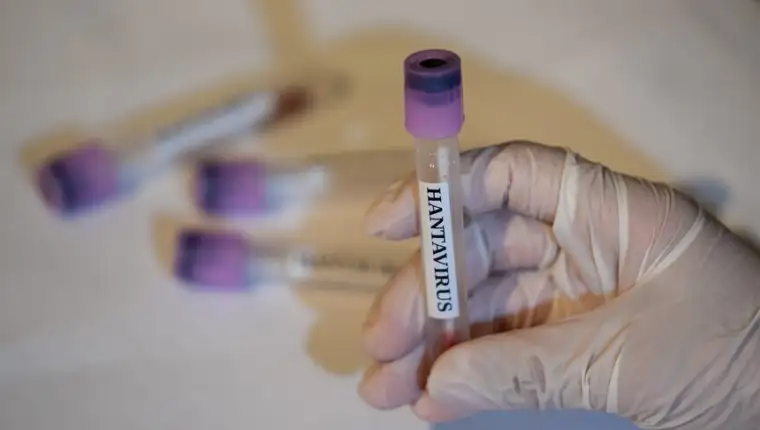 Hantavirus aa