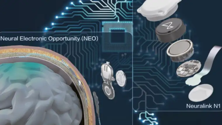 Neural Electronic Opportunity