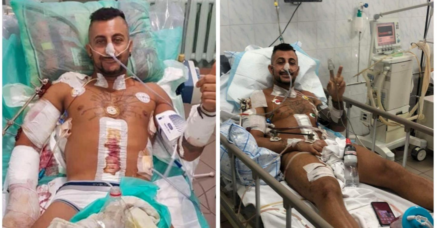 Rambo Shareef Amin u bolničkom krevetu uslikan dva puta slika podijeljena napola leži u donjem vešu na tijelu brojni flasteri i zavoji u nosu cjevčica osmijeh na licu bijela posteljina pored njega medicinski aparati