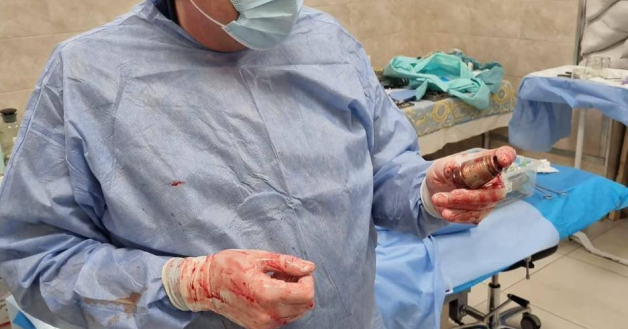 Ljekari u Ukrajini izvadili su neeksplodiranu granatu iz prsa vojnika. Na Facebooku medicinske službe oružanih snaga objavljena fotografija